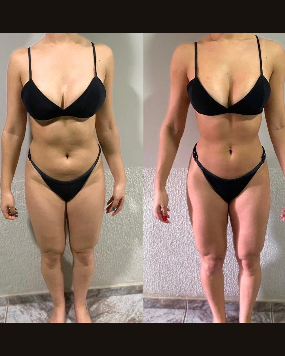 Transformação antes e depois — aluna 3