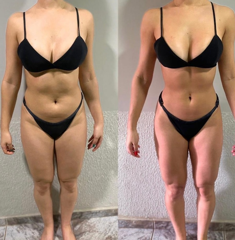 Transformação antes e depois — aluna 2
